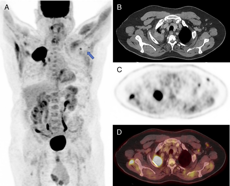 FIGURE 1