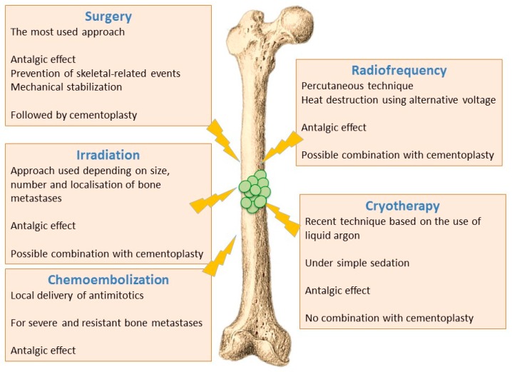 Understanding the Progression of Bone Metastases to Identify Novel ...