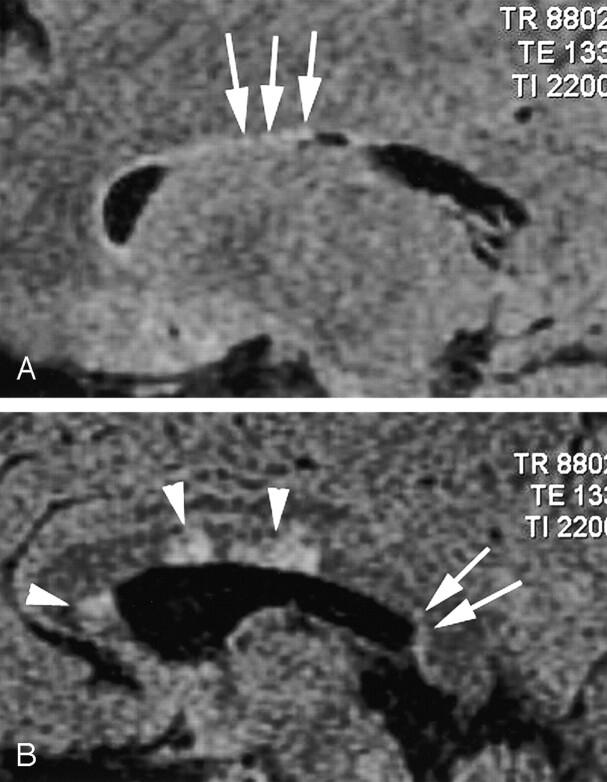 Fig 3.