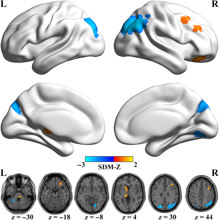 FIGURE 2