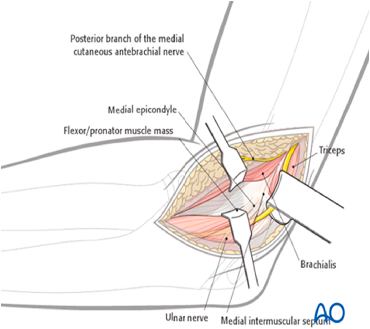 Fig. 10