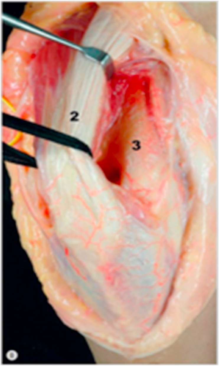 Fig. 23