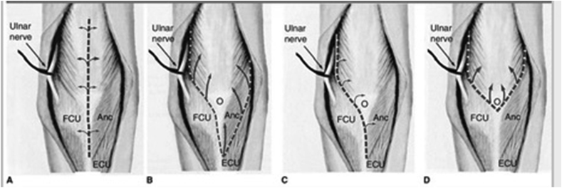 Fig. 19