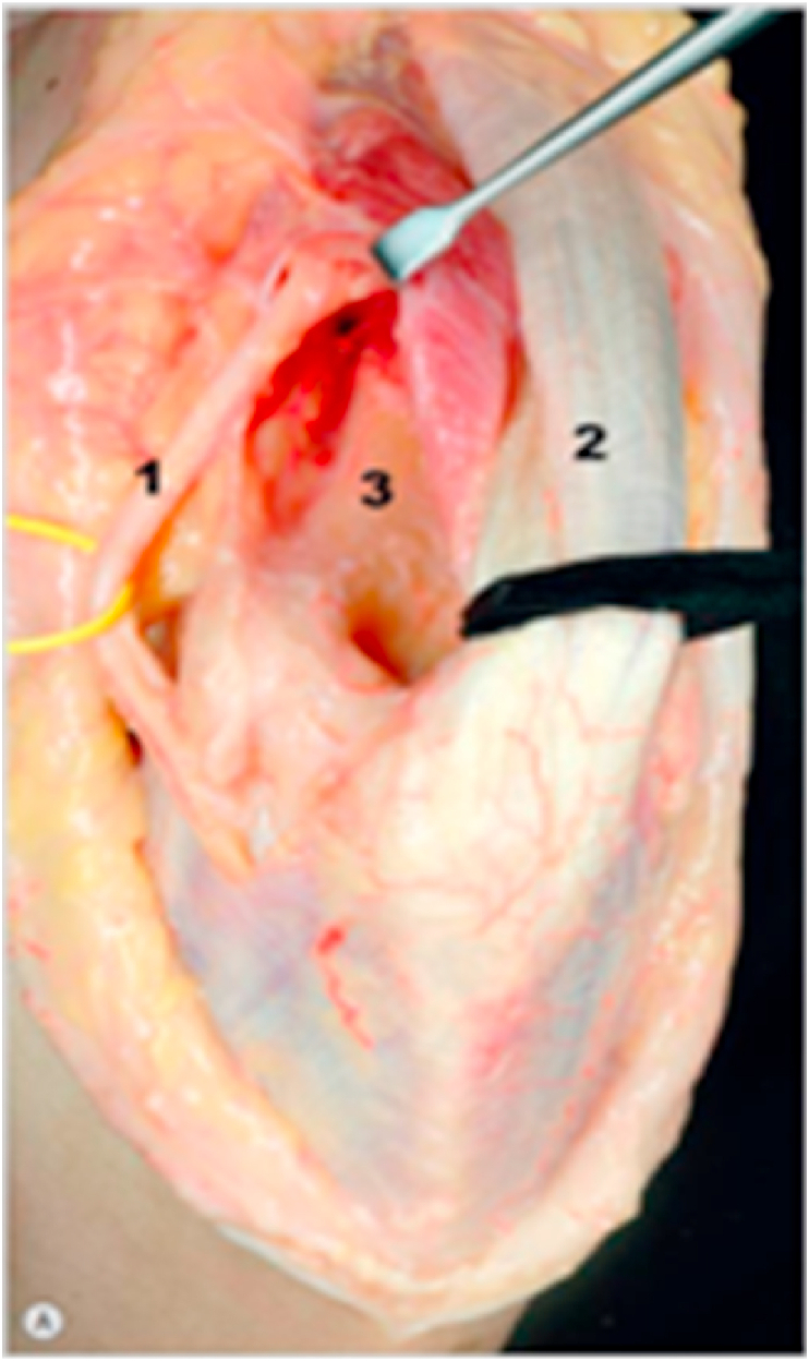 Fig. 22