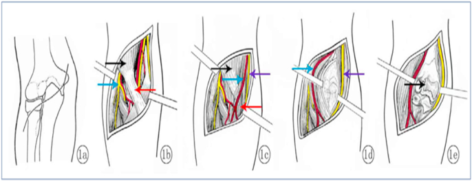 Fig. 15