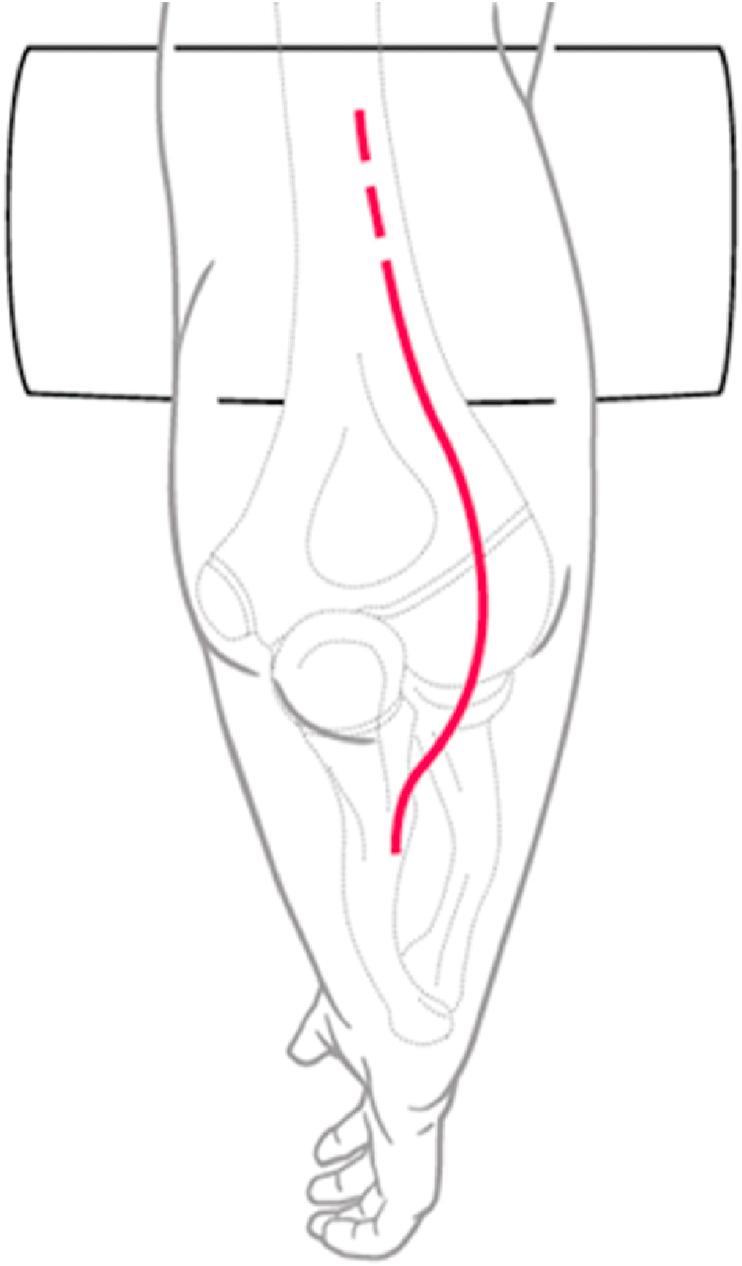 Fig. 16