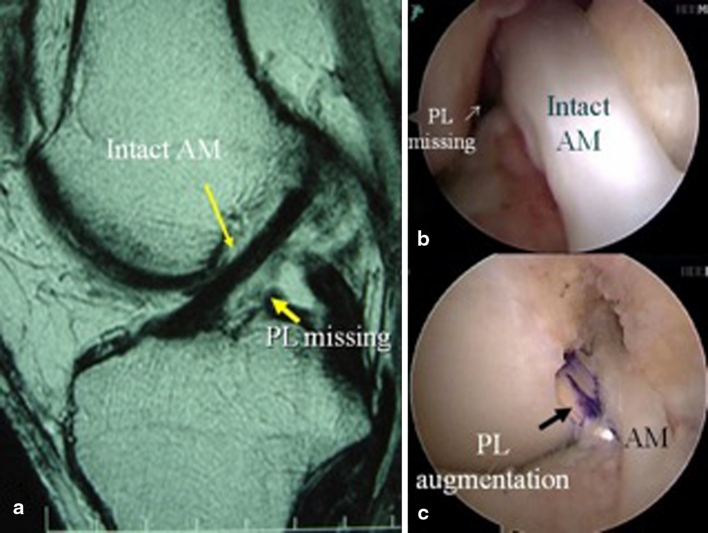 Fig. 2