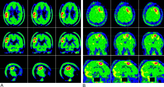 Fig 3.