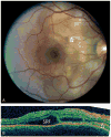 Fig. 3