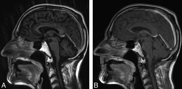 Fig 2.