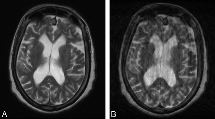 Fig 3.