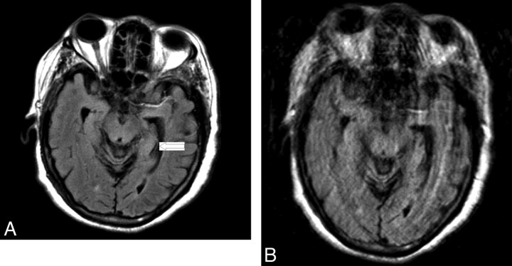 Fig 4.