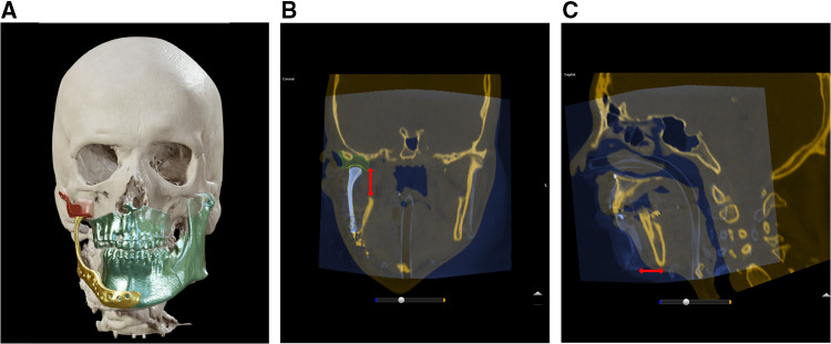 Fig. 4
