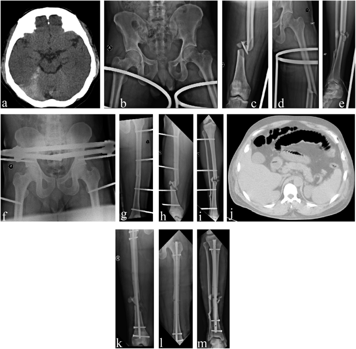 Fig. 2