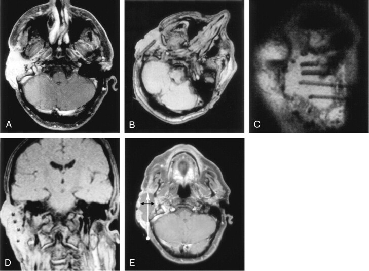 Fig 3.