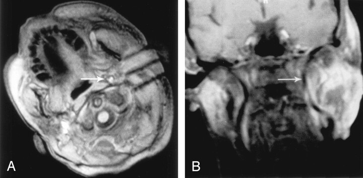 Fig 5.