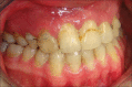 Figure 21