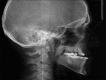 Figure 28