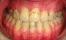 Figure 20