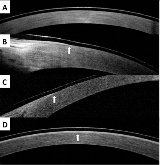 Fig. (1)