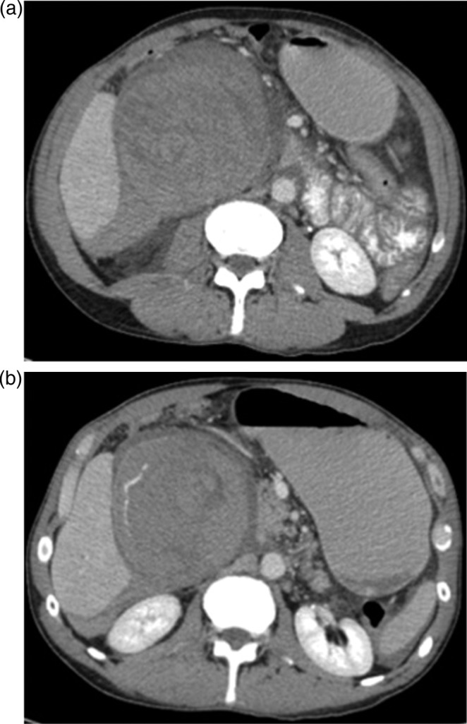 Figure 1: