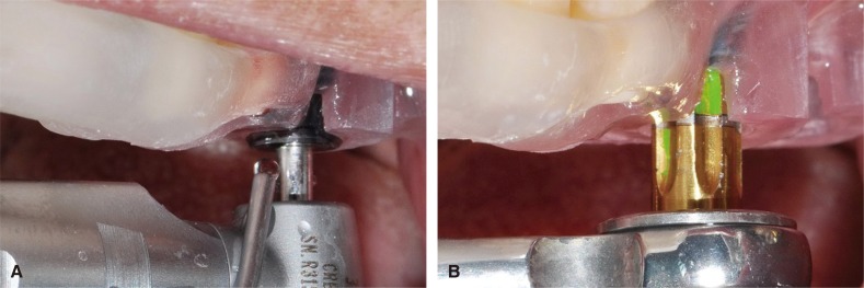 Fig. 5