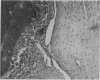 210