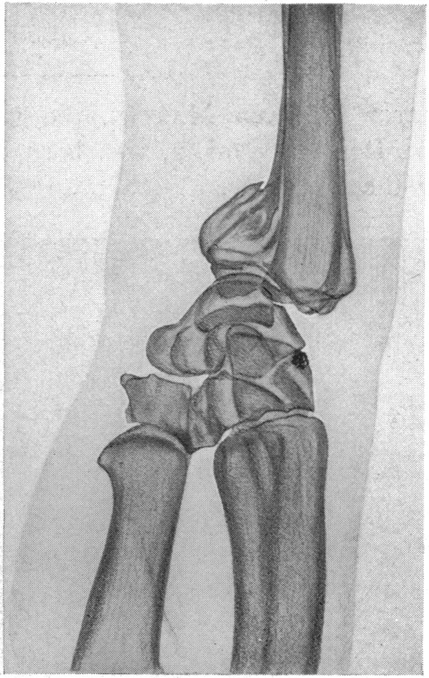 FIG. 5.