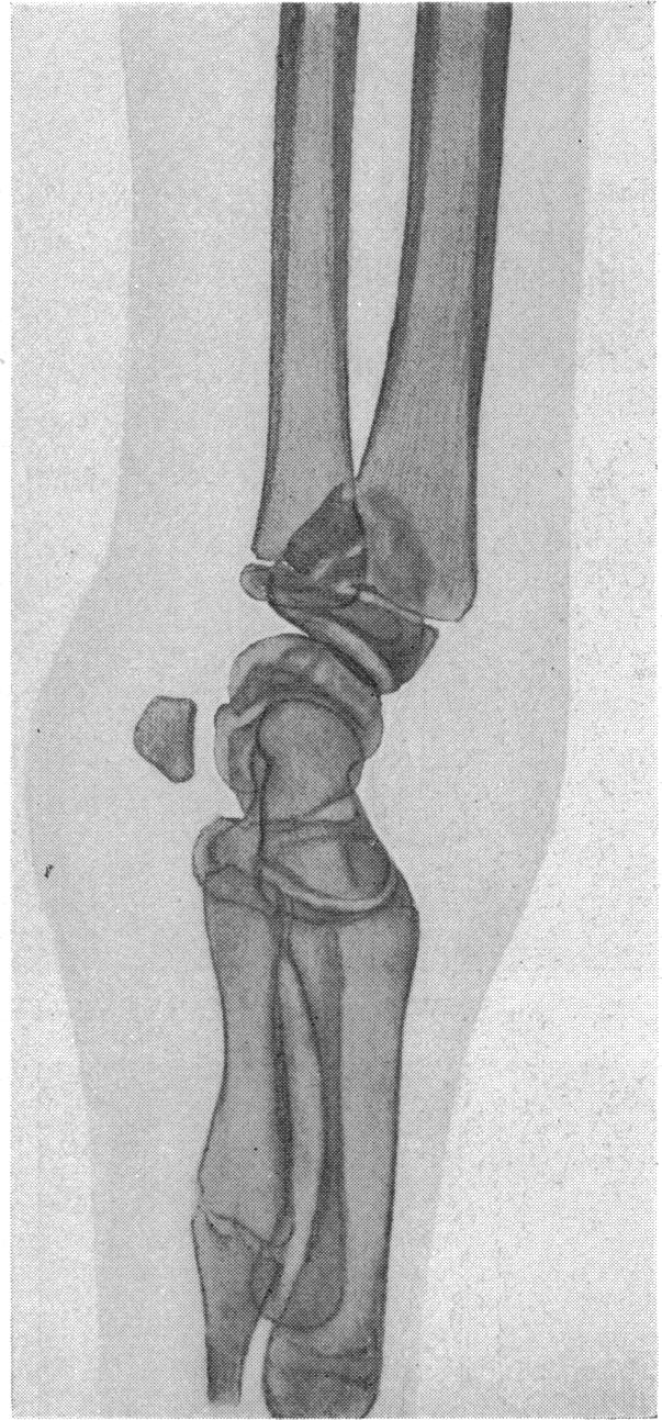 FIG. 2.