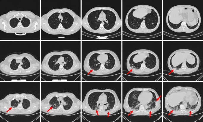 Fig. 1