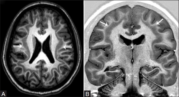 Figure 10(A and B)