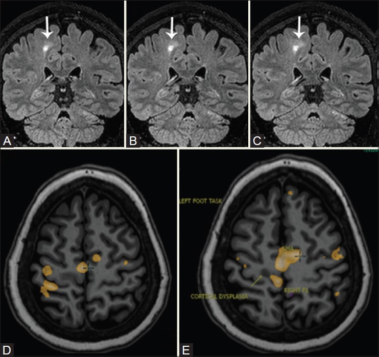 Figure 19(A-E)