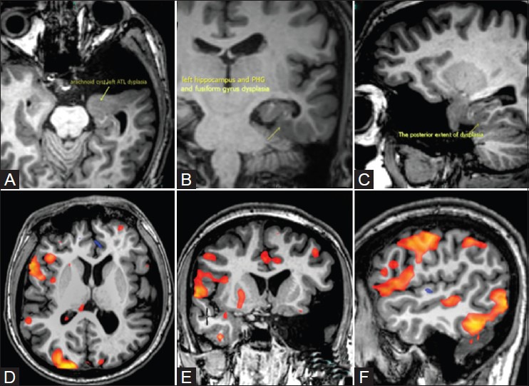 Figure 23(A-F)