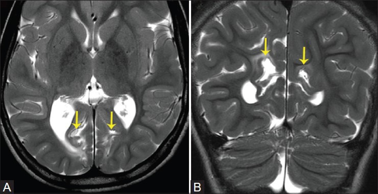 Figure 15(A and B)