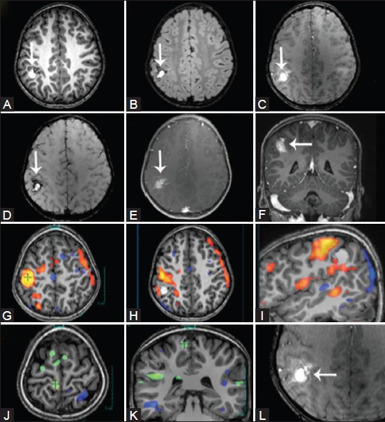 Figure 13(A-L)