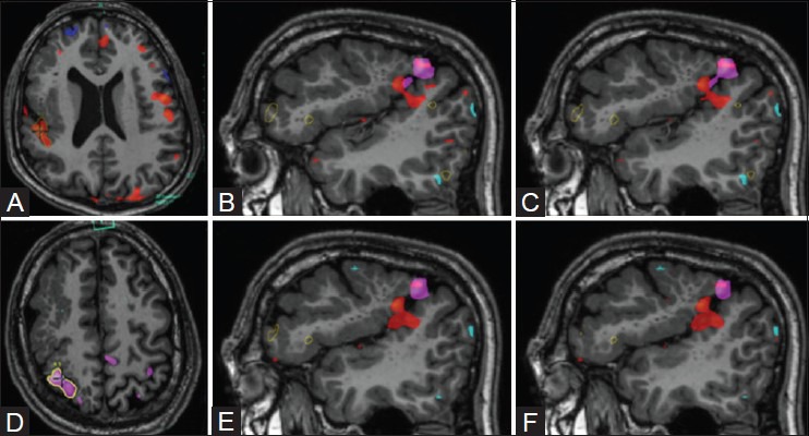 Figure 12(A-F)