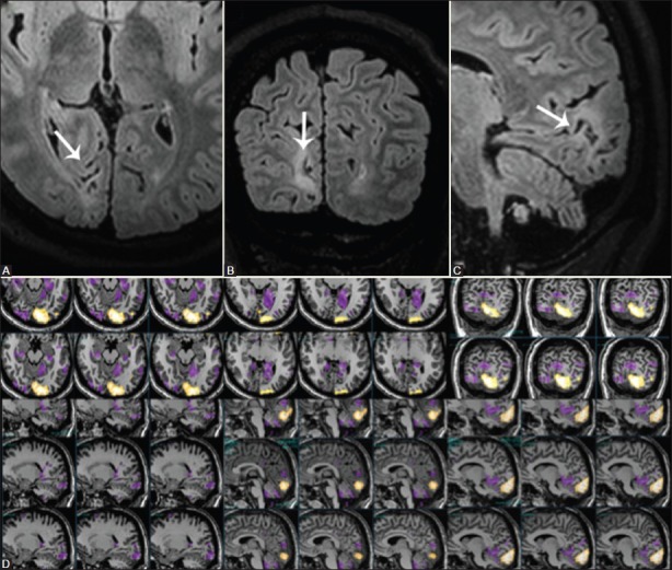 Figure 17(A-D)