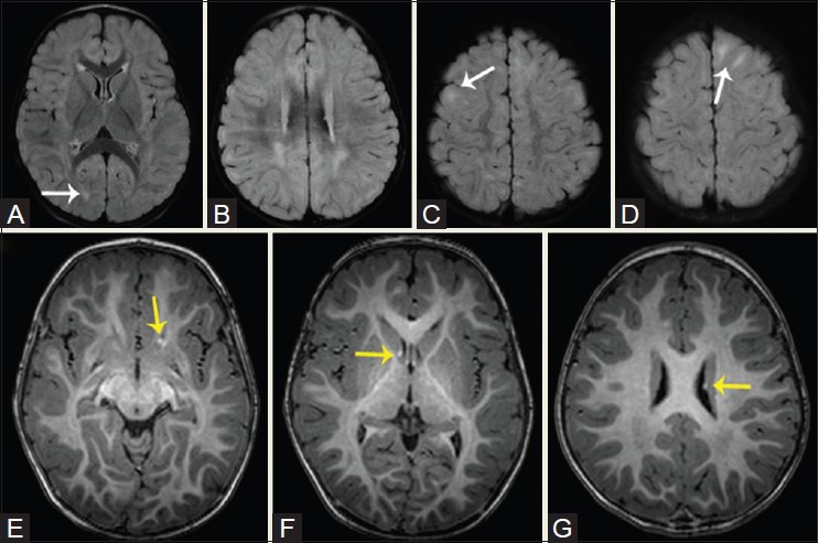 Figure 16(A-G)