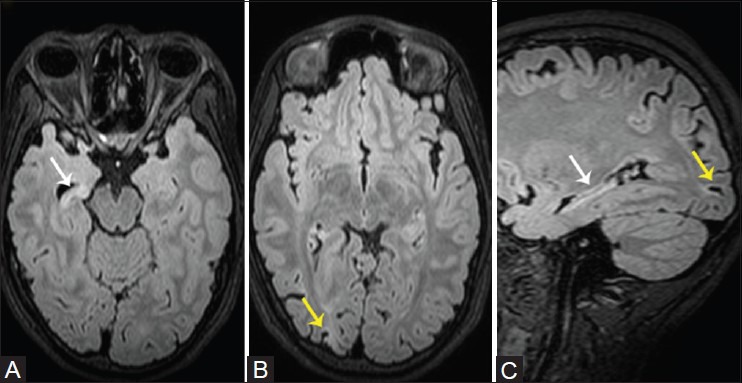 Figure 3(A and C)