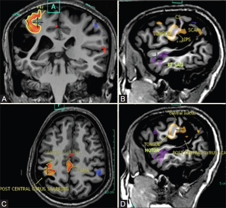 Figure 20(A-D)