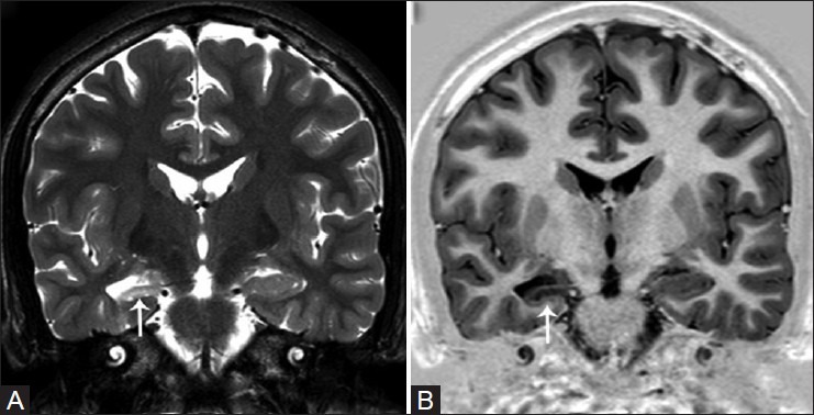 Figure 1(A and B)