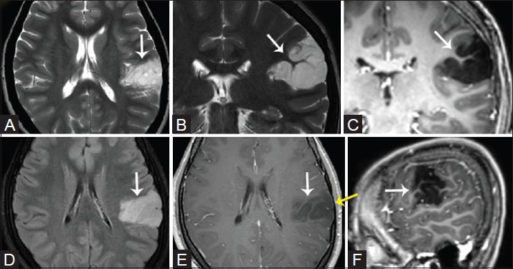 Figure 7(A-F)