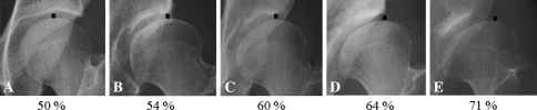 Fig. 4A–E