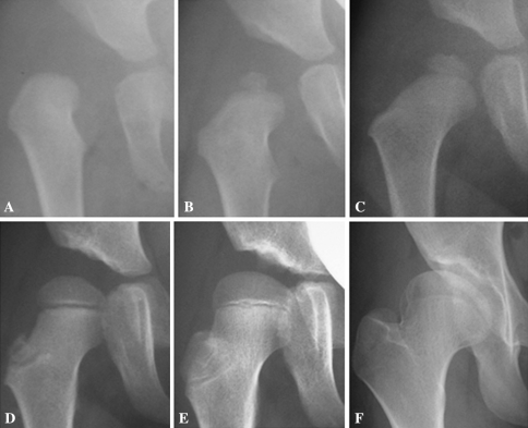 Fig. 5A–F