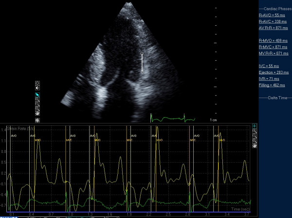 Figure 17