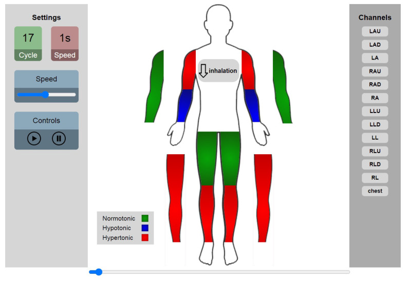 Figure 10