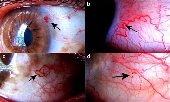 Fig. 2