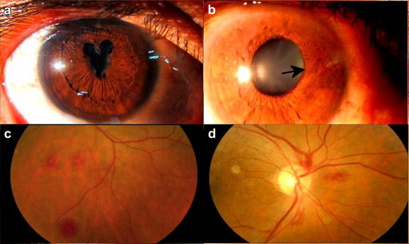 Fig. 3