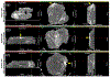 FIG. 3