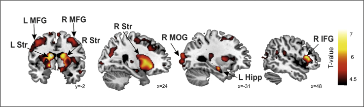 Fig. 2